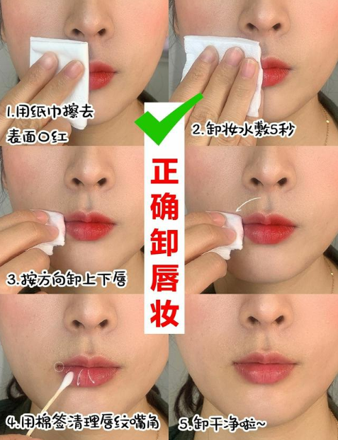 也有很多细节需要注意，今天和大家详细讲讲.png