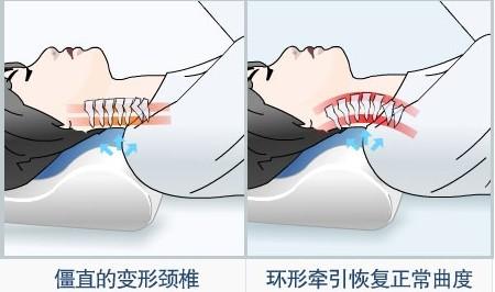颈椎枕.jpg